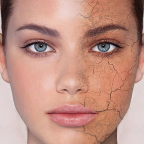 Dry Skin Dry Skin