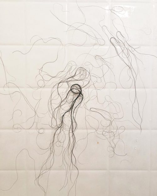 The most important hair loss causes The most important causes of hair loss