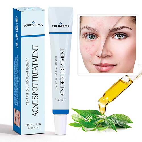 Puriderma Acne Spot Treatment for for mild, moderate, severe and cystic acne, best acne spot treatments 2020