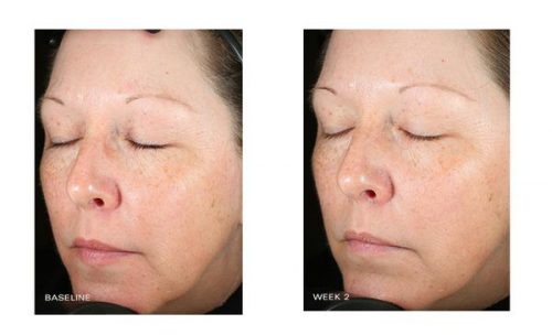 Get Quick Results with ZO Skin Health Brightalive Skin Brightener which, is the best skin brightening in 2021! Get Quick Results with ZO Skin Health Brightalive Skin Brightener which, is the best skin brightening in 2021!