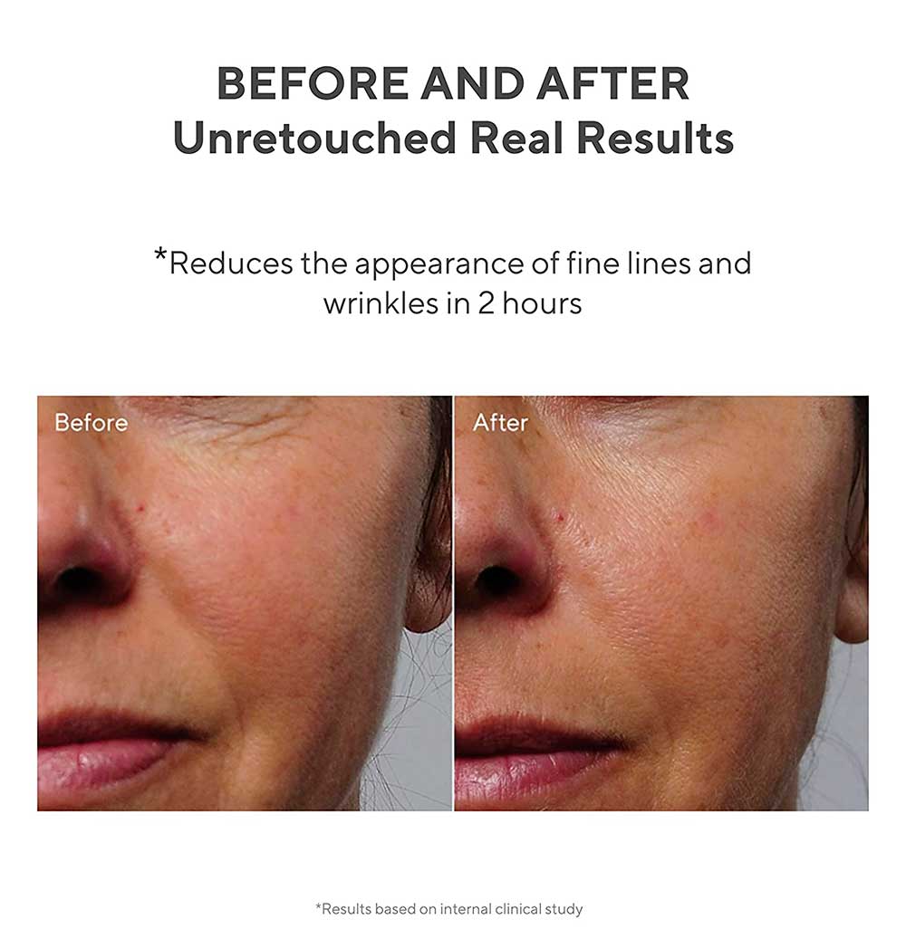 Murad Rapid Collagen Infusion for Even Skin Texture