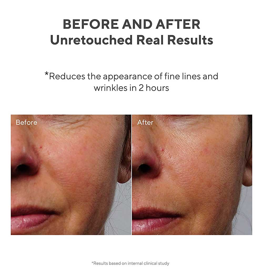 Collagen Cream for Face and Neck Smooths and Visibly Minimizes Wrinkles Murad Rapid Collagen Infusion for Even Skin Texture