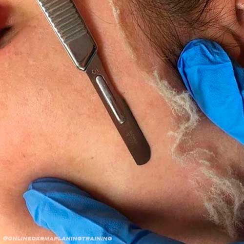 What is Dermaplaning and The Side Effects of Dermaplaning Technique What is Dermaplaning and The Side Effects of Dermaplaning Technique