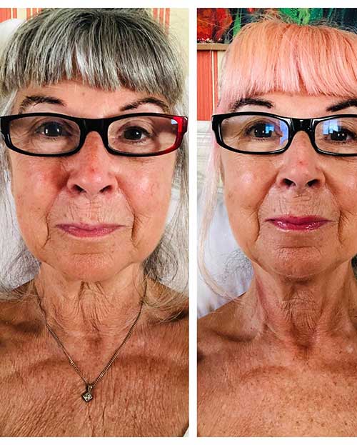 neck cream before after